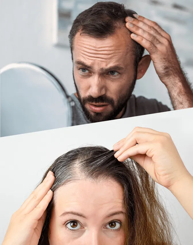 Woman with thinning hair at the partition before female hair transplant